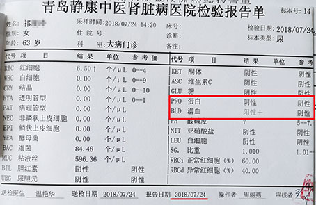 (祁阿姨复查时尿检化验单)(祁阿姨24小时尿蛋白定量前后对比)7月中旬