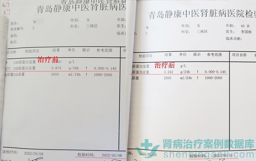 患了狼疮肾病很恐慌？山东青岛静康医院治疗得当可转阴！