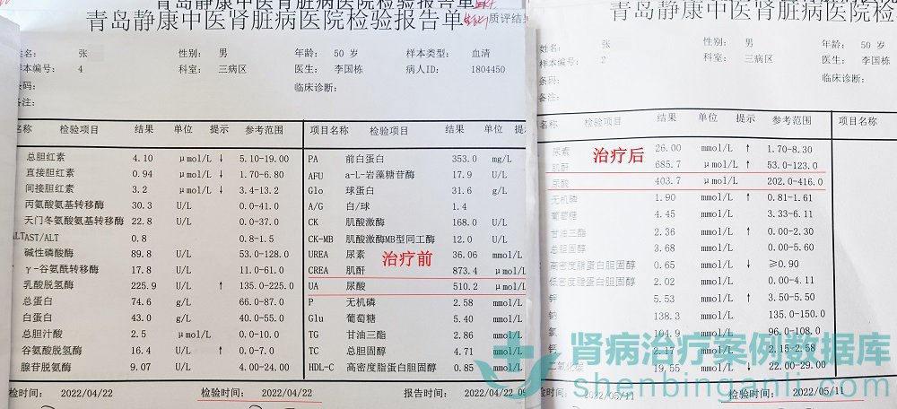 没有不适却被诊断尿毒症！感谢青岛静康医院不透析太好了！